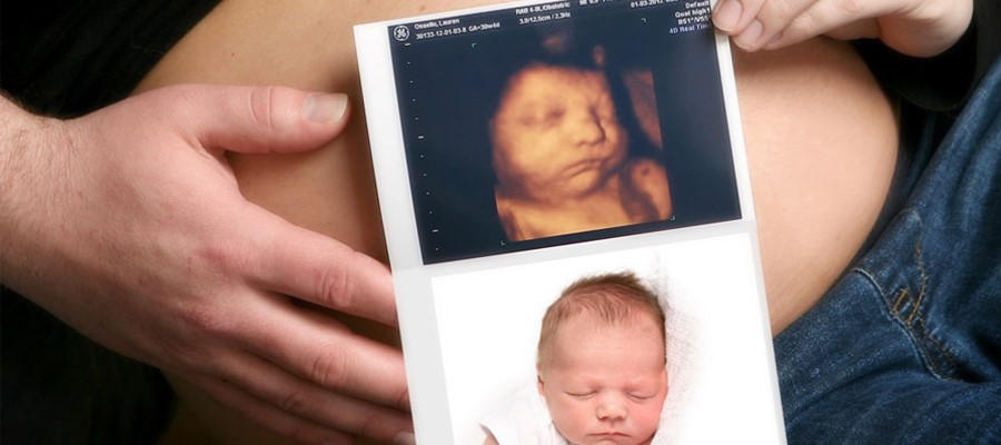 Best Sonography in Udaipur at Medicentre Sonography and Clinical Lab