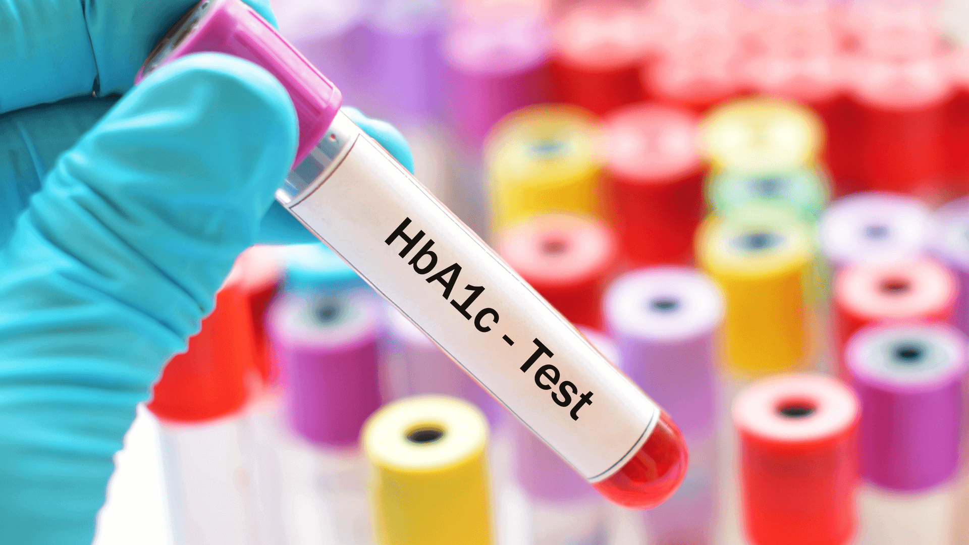 Hb1Ac Test