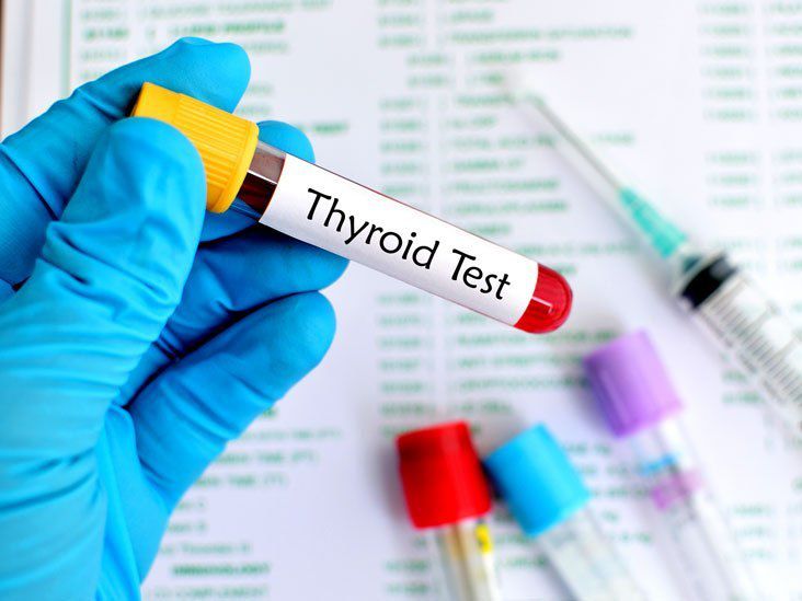 TSH Test